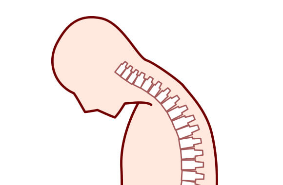 首下がり症候群のイラスト