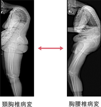 上位胸椎病変と胸腰椎病変