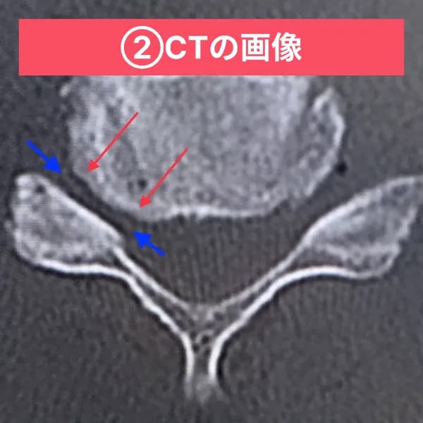 CT画像